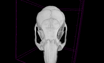 Craniosynostosis-wild type (normal)