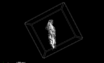 Evaluation of Extracted Thrombotic Material Characteristics